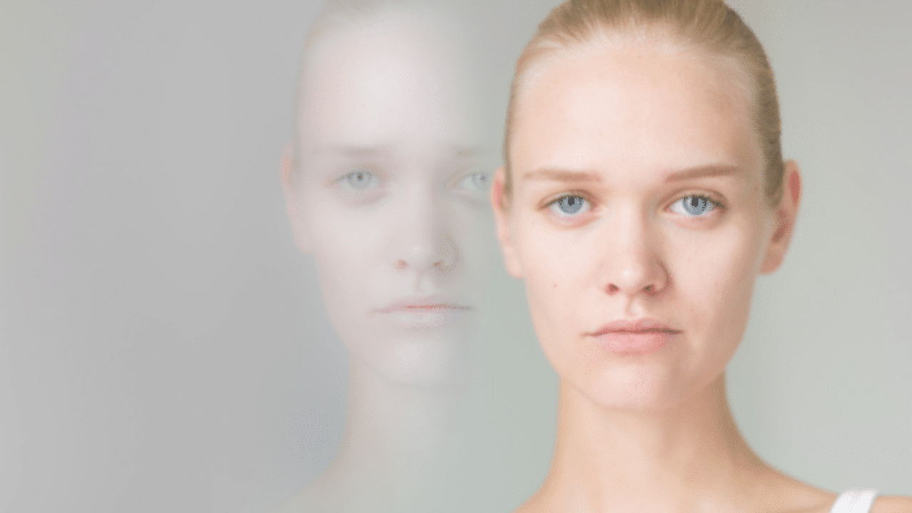 surto psicótico o que é e como tratar (2)